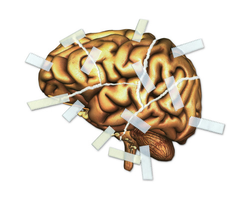 traumatic-brain-injury