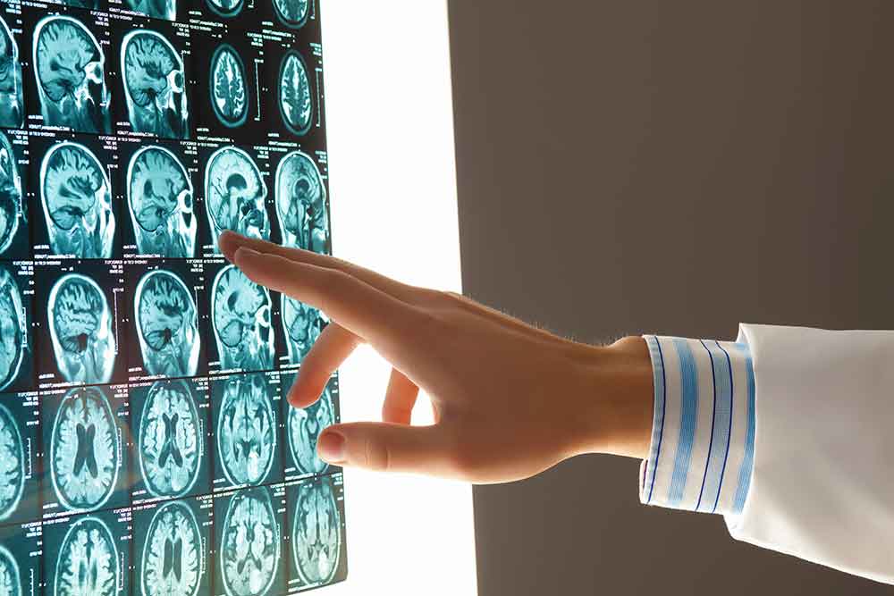 Brain Injury Settlement Amount in Colorado